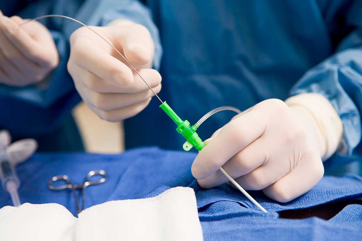 Catheterization