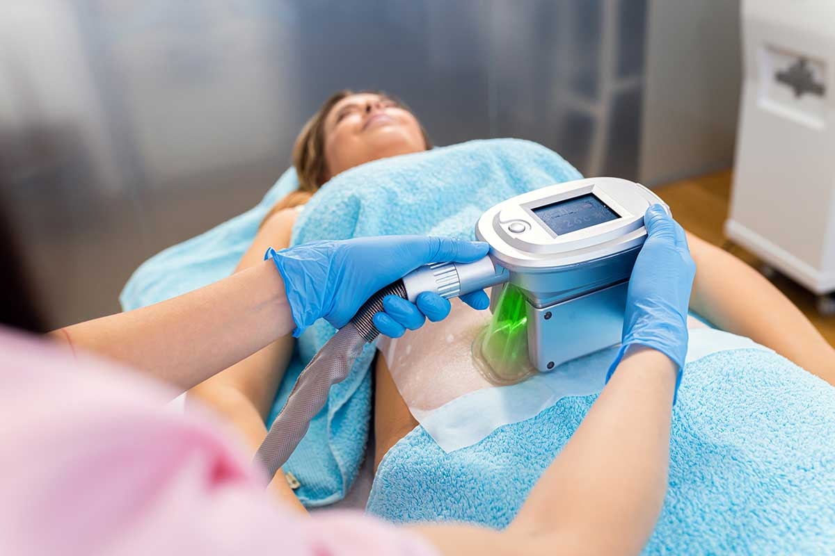 Cryolipolysis