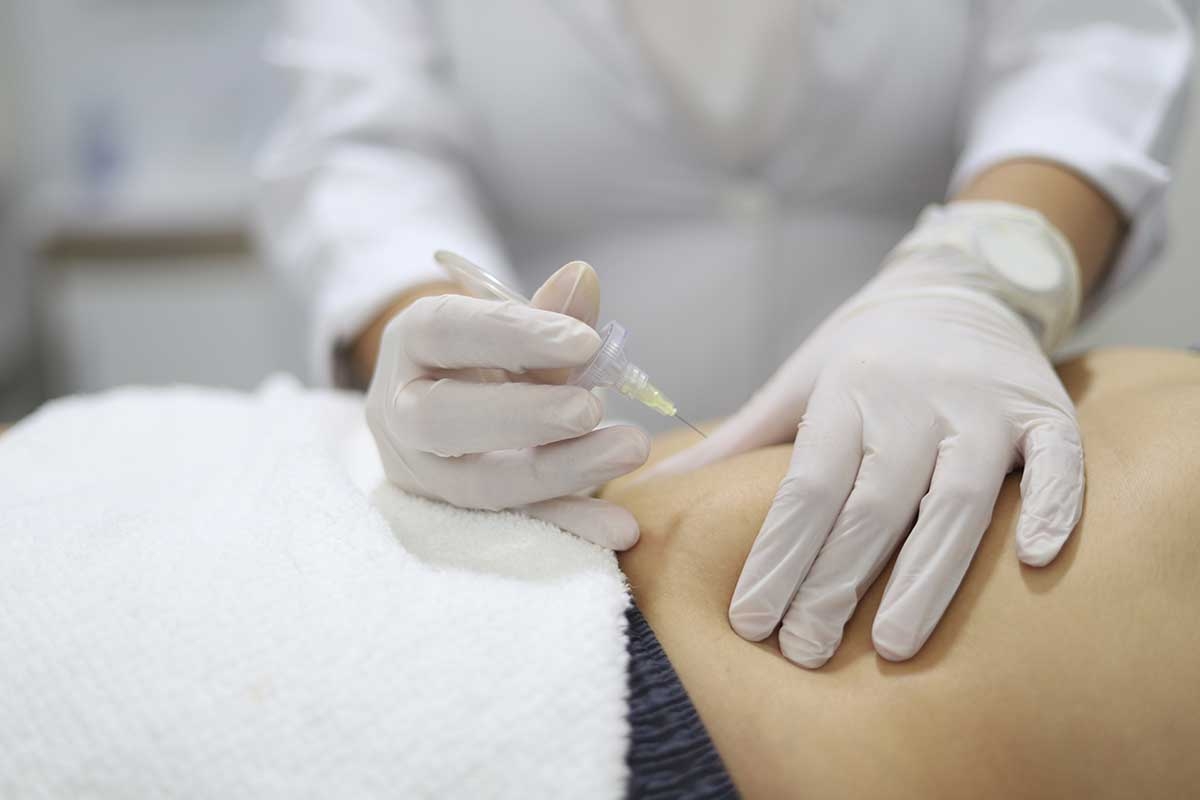 Carboxytherapy